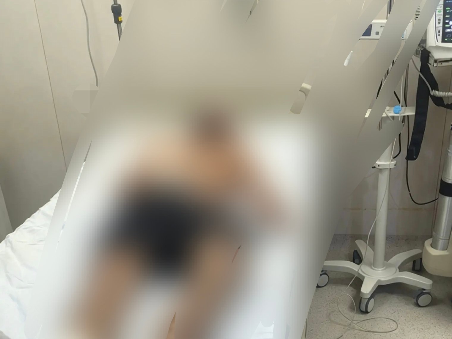 Riña termina en agresión con arma punzo cortante a jovén en Alto Lucero